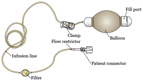 Example of an elastomeric device and its parts