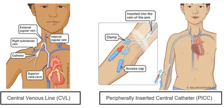 central venous access devices